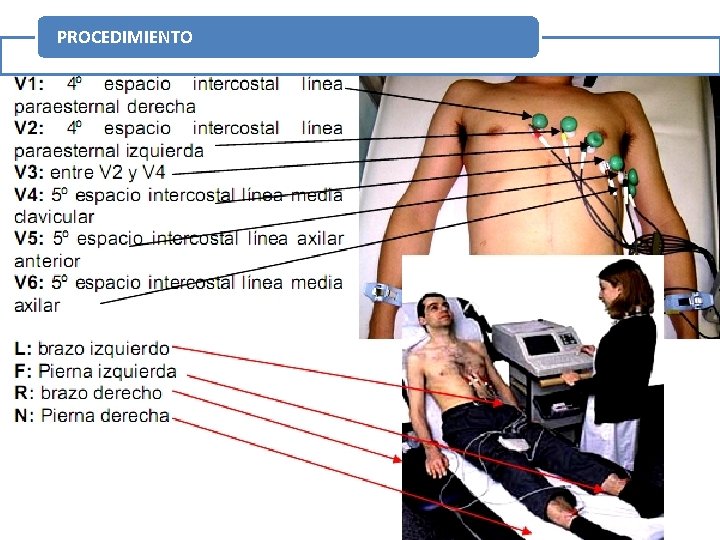 PROCEDIMIENTO 20 