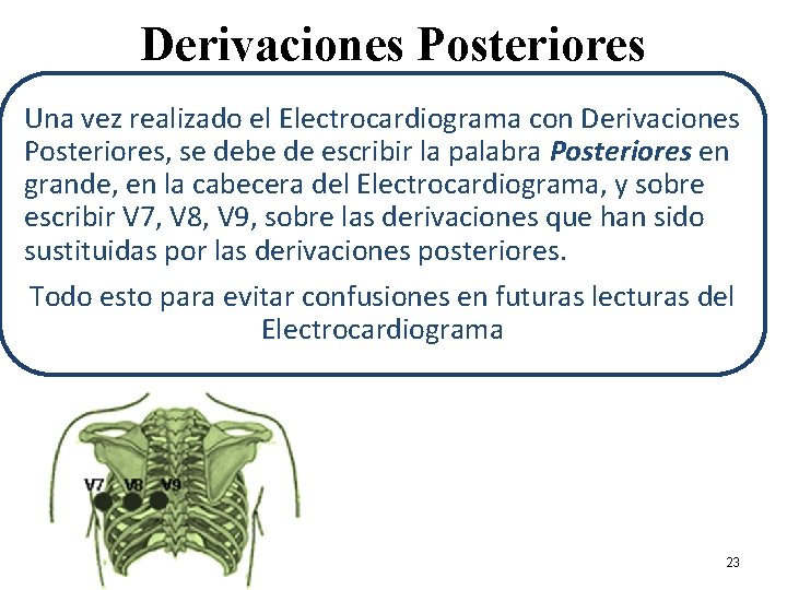 Derivaciones Posteriores Una vez realizado el Electrocardiograma con Derivaciones Posteriores, se debe de escribir