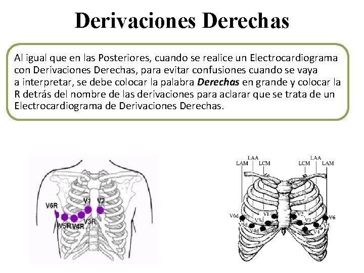 Derivaciones Derechas Al igual que en las Posteriores, cuando se realice un Electrocardiograma con