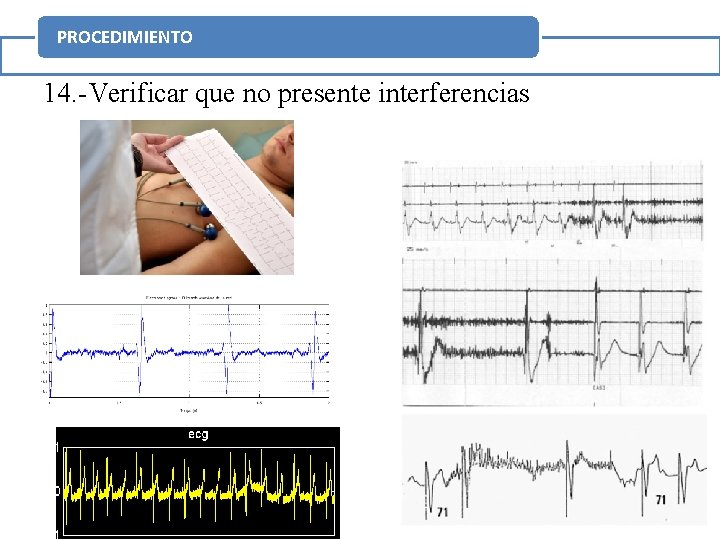 PROCEDIMIENTO 14. -Verificar que no presente interferencias 28 