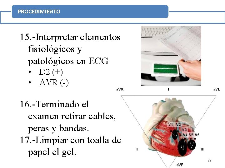 PROCEDIMIENTO 15. -Interpretar elementos fisiológicos y patológicos en ECG • D 2 (+) •