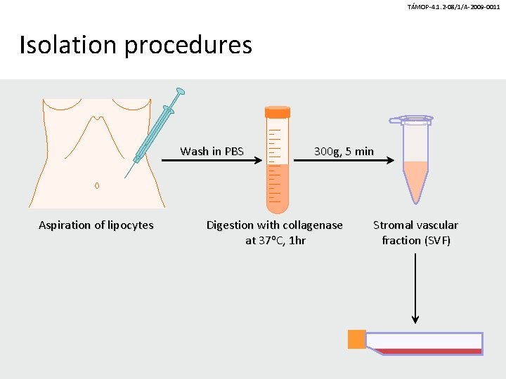 TÁMOP-4. 1. 2 -08/1/A-2009 -0011 Isolation procedures Wash in PBS Aspiration of lipocytes 300