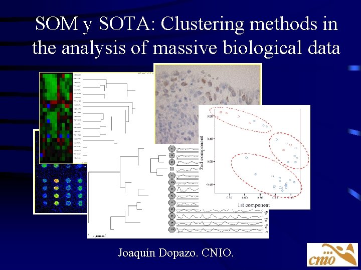 SOM y SOTA: Clustering methods in the analysis of massive biological data Joaquín Dopazo.