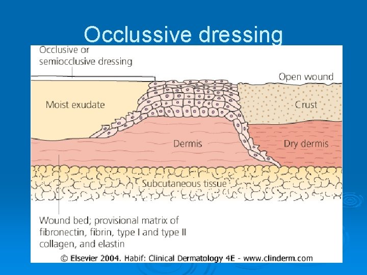 Occlussive dressing 