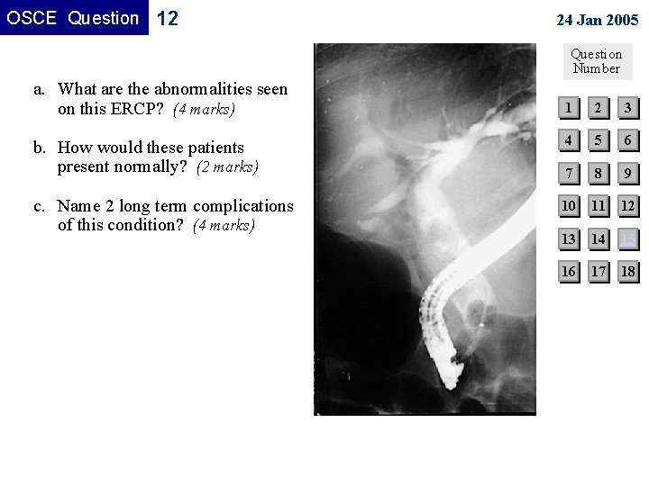 OSCE Question 12 24 Jan 2005 Question Number a. What are the abnormalities seen OSCE Question 12 24 Jan 2005 Question Number a. What are the abnormalities seen