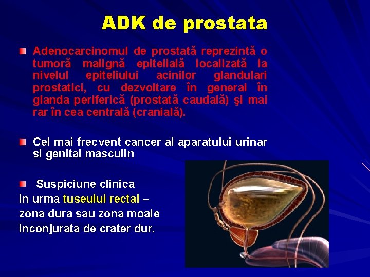 tratamentul prostatitei la bărbați simptome tratament pentru prostatita și adenom de prostată