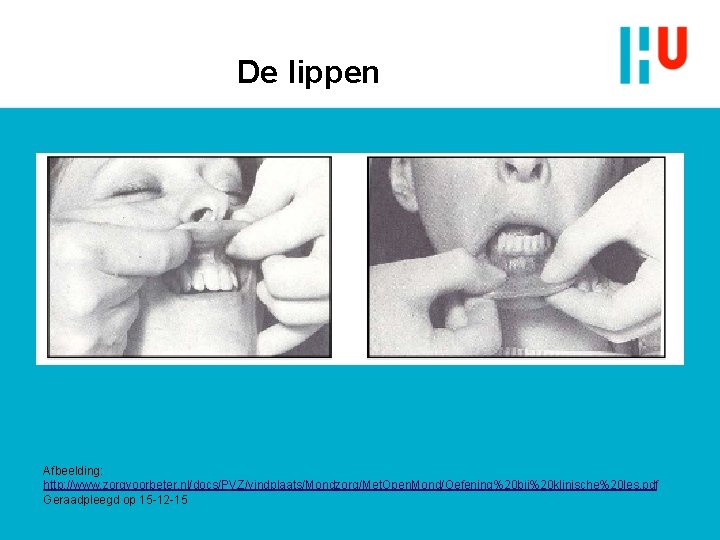 De lippen Afbeelding: http: //www. zorgvoorbeter. nl/docs/PVZ/vindplaats/Mondzorg/Met. Open. Mond/Oefening%20 bij%20 klinische%20 les. pdf Geraadpleegd De lippen Afbeelding: http: //www. zorgvoorbeter. nl/docs/PVZ/vindplaats/Mondzorg/Met. Open. Mond/Oefening%20 bij%20 klinische%20 les. pdf Geraadpleegd