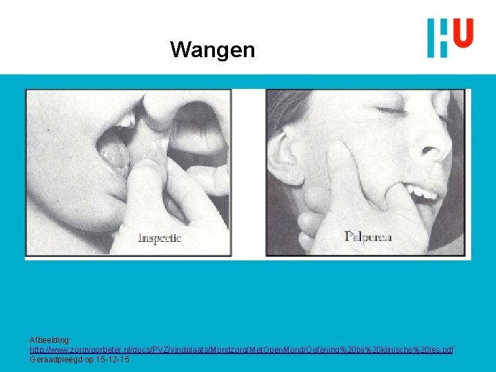 Wangen Afbeelding: http: //www. zorgvoorbeter. nl/docs/PVZ/vindplaats/Mondzorg/Met. Open. Mond/Oefening%20 bij%20 klinische%20 les. pdf Geraadpleegd op Wangen Afbeelding: http: //www. zorgvoorbeter. nl/docs/PVZ/vindplaats/Mondzorg/Met. Open. Mond/Oefening%20 bij%20 klinische%20 les. pdf Geraadpleegd op