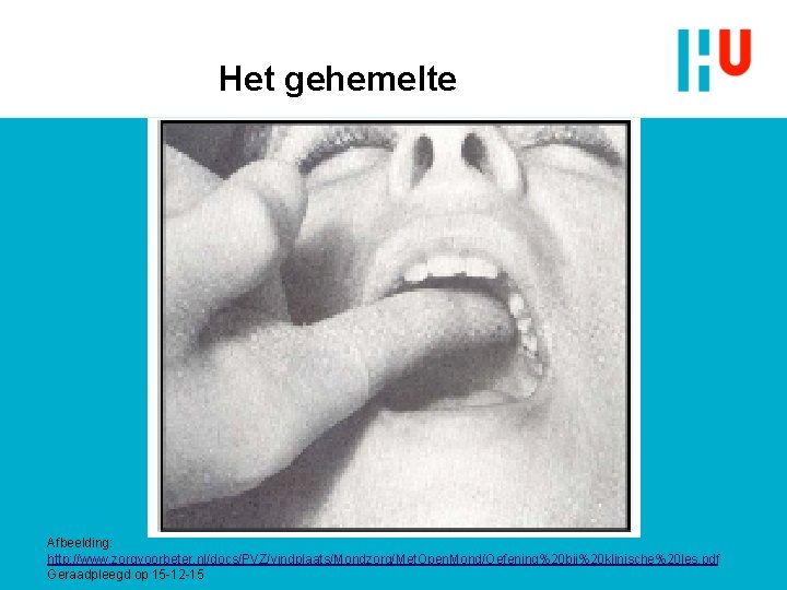 Het gehemelte Afbeelding: http: //www. zorgvoorbeter. nl/docs/PVZ/vindplaats/Mondzorg/Met. Open. Mond/Oefening%20 bij%20 klinische%20 les. pdf Geraadpleegd Het gehemelte Afbeelding: http: //www. zorgvoorbeter. nl/docs/PVZ/vindplaats/Mondzorg/Met. Open. Mond/Oefening%20 bij%20 klinische%20 les. pdf Geraadpleegd