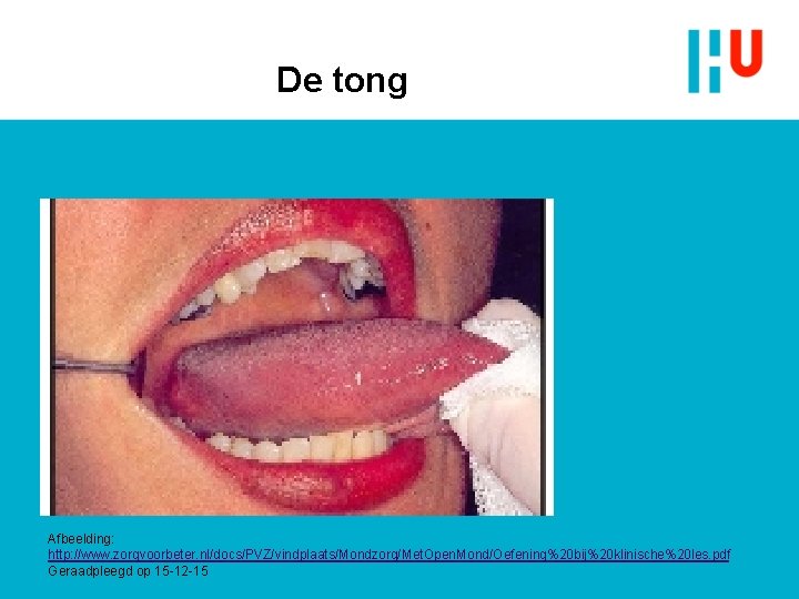 De tong Afbeelding: http: //www. zorgvoorbeter. nl/docs/PVZ/vindplaats/Mondzorg/Met. Open. Mond/Oefening%20 bij%20 klinische%20 les. pdf Geraadpleegd De tong Afbeelding: http: //www. zorgvoorbeter. nl/docs/PVZ/vindplaats/Mondzorg/Met. Open. Mond/Oefening%20 bij%20 klinische%20 les. pdf Geraadpleegd