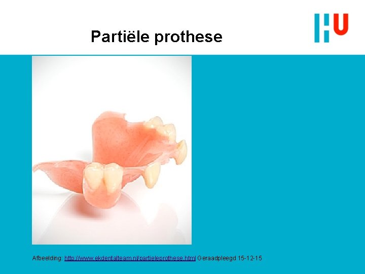 Partiële prothese Afbeelding: http: //www. ekdentalteam. nl/partieleprothese. html Geraadpleegd 15 -12 -15 Partiële prothese Afbeelding: http: //www. ekdentalteam. nl/partieleprothese. html Geraadpleegd 15 -12 -15