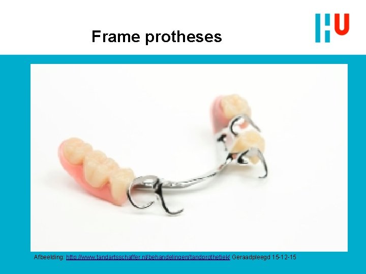Frame protheses Afbeelding: http: //www. tandartsschaffer. nl/behandelingen/tandprothetiek/ Geraadpleegd 15 -12 -15 Frame protheses Afbeelding: http: //www. tandartsschaffer. nl/behandelingen/tandprothetiek/ Geraadpleegd 15 -12 -15