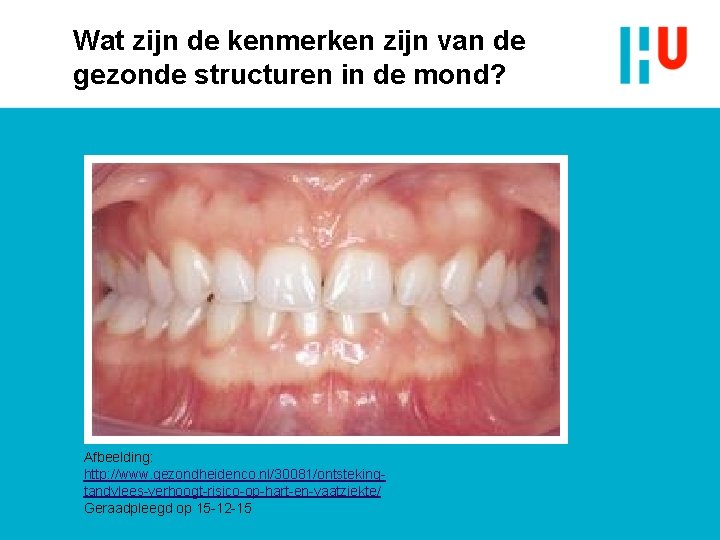 Wat zijn de kenmerken zijn van de gezonde structuren in de mond? Afbeelding: http: Wat zijn de kenmerken zijn van de gezonde structuren in de mond? Afbeelding: http: