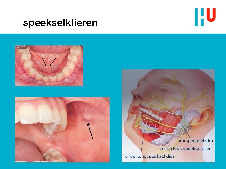 speekselklieren speekselklieren