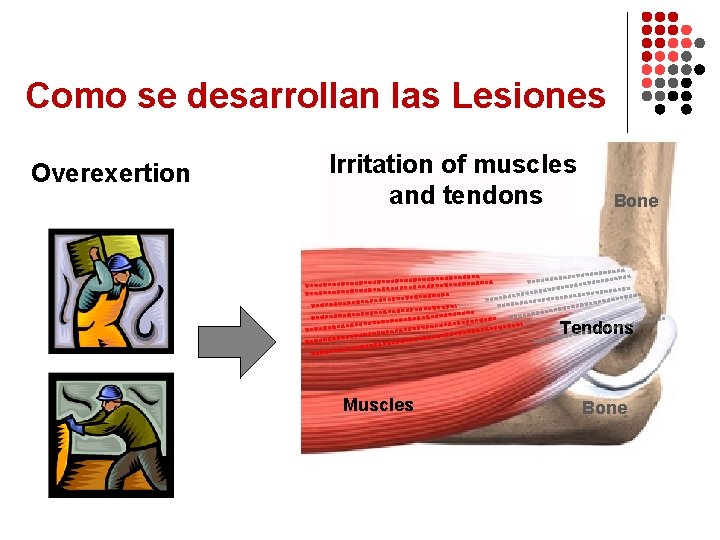 Como se desarrollan las Lesiones Overexertion Irritation of muscles and tendons Bone Tendons Muscles
