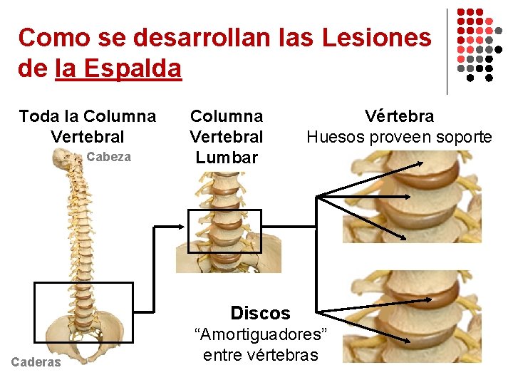 Como se desarrollan las Lesiones de la Espalda Toda la Columna Vertebral Cabeza Columna