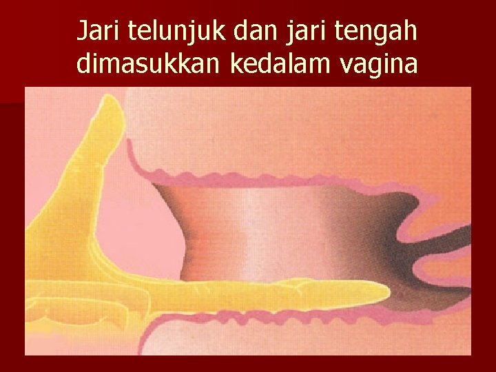 Jari telunjuk dan jari tengah dimasukkan kedalam vagina 