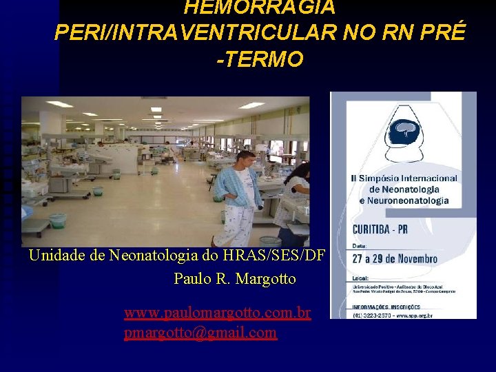 HEMORRAGIA PERI/INTRAVENTRICULAR NO RN PRÉ -TERMO Unidade de Neonatologia do HRAS/SES/DF Paulo R. Margotto