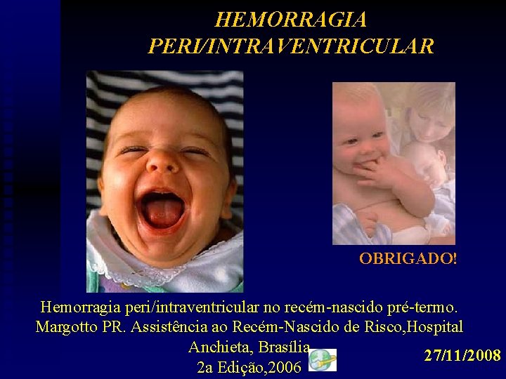 HEMORRAGIA PERI/INTRAVENTRICULAR OBRIGADO! Hemorragia peri/intraventricular no recém-nascido pré-termo. Margotto PR. Assistência ao Recém-Nascido de