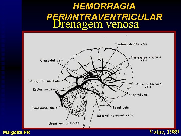 HEMORRAGIA PERI/INTRAVENTRICULAR Drenagem venosa Margotto, PR Volpe, 1989 
