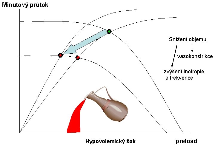 Minutový průtok Snížení objemu vasokonstrikce zvýšení inotropie a frekvence Hypovolemický šok preload 