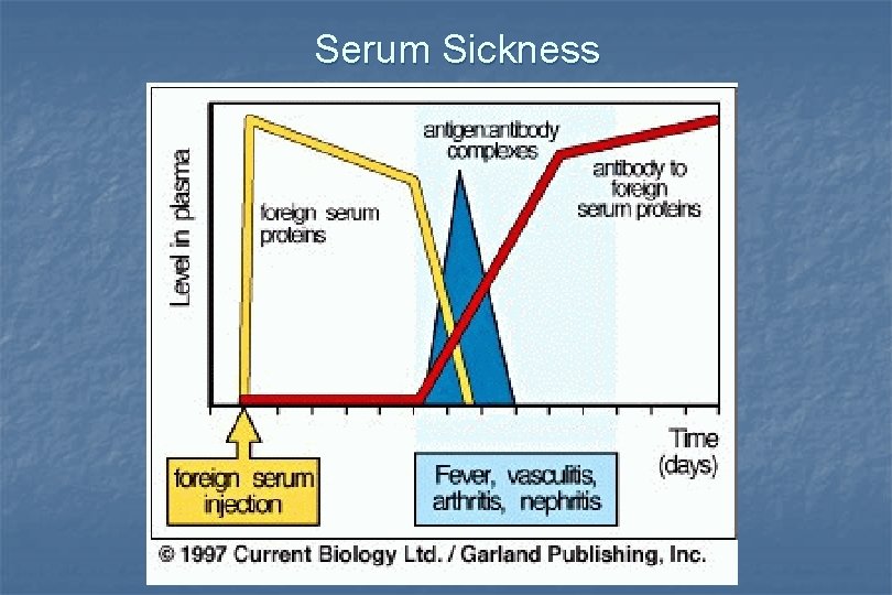 Serum Sickness 