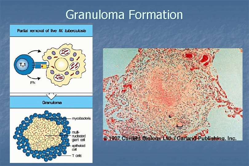 Granuloma Formation 