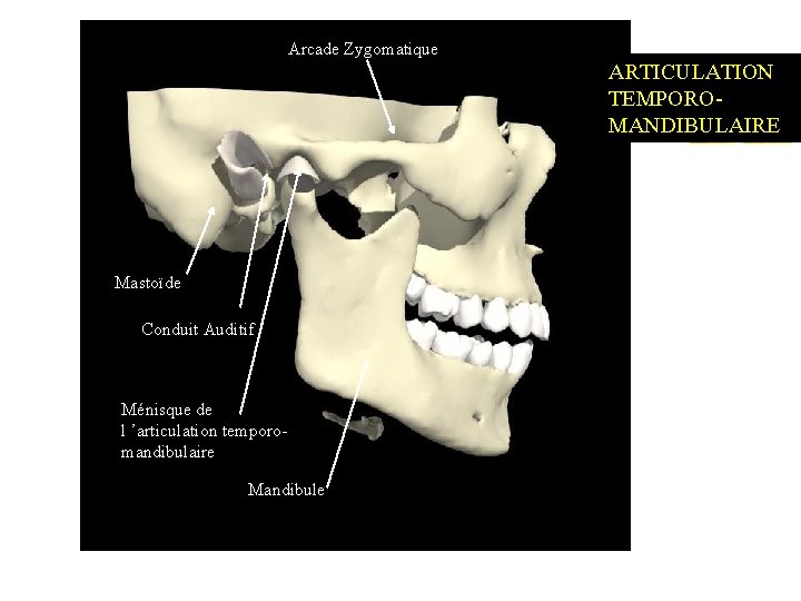 Arcade Zygomatique ARTICULATION TEMPOROMANDIBULAIRE Mastoïde Conduit Auditif Ménisque de l ’articulation temporo- mandibulaire Mandibule