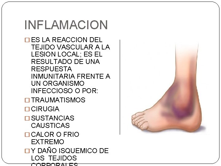 INFLAMACION � ES LA REACCION DEL TEJIDO VASCULAR A LA LESION LOCAL; ES EL