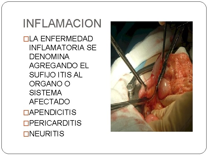 INFLAMACION �LA ENFERMEDAD INFLAMATORIA SE DENOMINA AGREGANDO EL SUFIJO ITIS AL ORGANO O SISTEMA