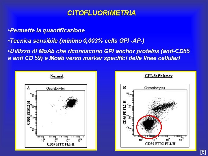 CITOFLUORIMETRIA • Permette la quantificazione • Tecnica sensibile (minimo 0, 003% cells GPI -AP-)