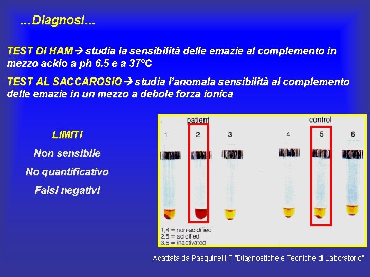 …Diagnosi… TEST DI HAM studia la sensibilità delle emazie al complemento in mezzo acido