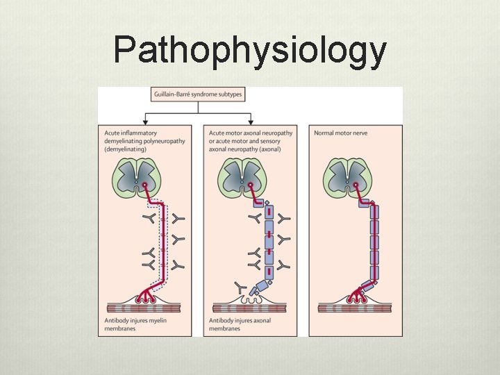Pathophysiology Pathophysiology