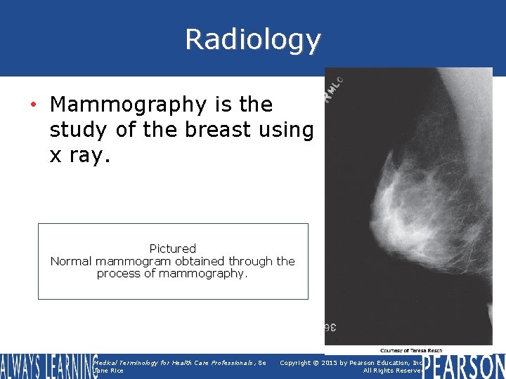 Radiology • Mammography is the study of the breast using x ray. Pictured Normal