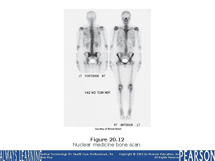 Figure 20. 12 Nuclear medicine bone scan. Medical Terminology for Health Care Professionals, 8