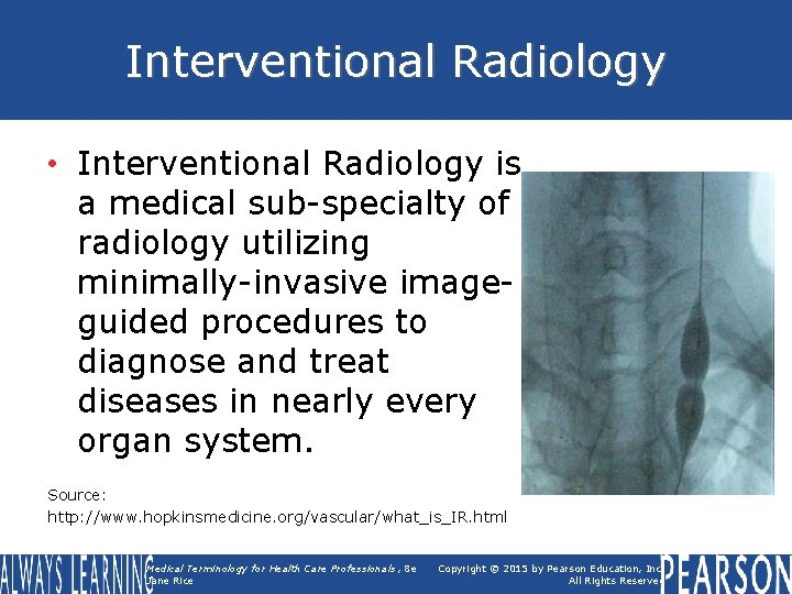 Interventional Radiology • Interventional Radiology is a medical sub-specialty of radiology utilizing minimally-invasive imageguided