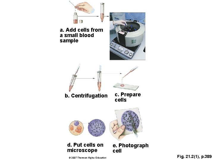 a. Add cells from a small blood sample b. Centrifugation d. Put cells on