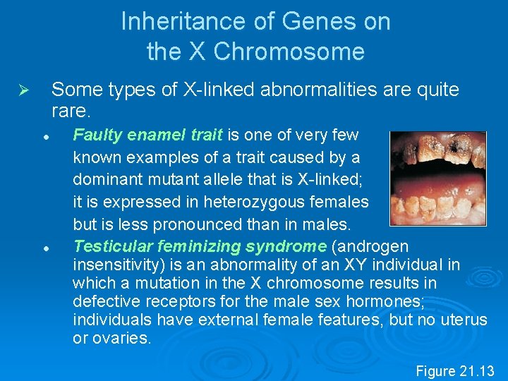 Inheritance of Genes on the X Chromosome Some types of X linked abnormalities are