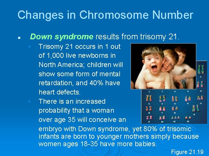 Changes in Chromosome Number l Down syndrome results from trisomy 21. • • Trisomy