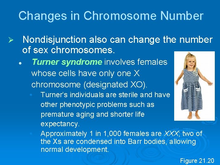 Changes in Chromosome Number Nondisjunction also can change the number of sex chromosomes. Ø