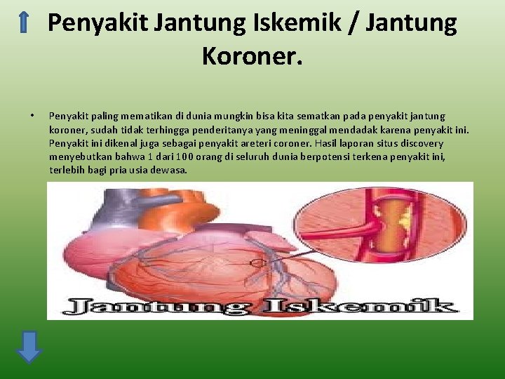 Penyakit Jantung Iskemik / Jantung Koroner. • Penyakit paling mematikan di dunia mungkin bisa