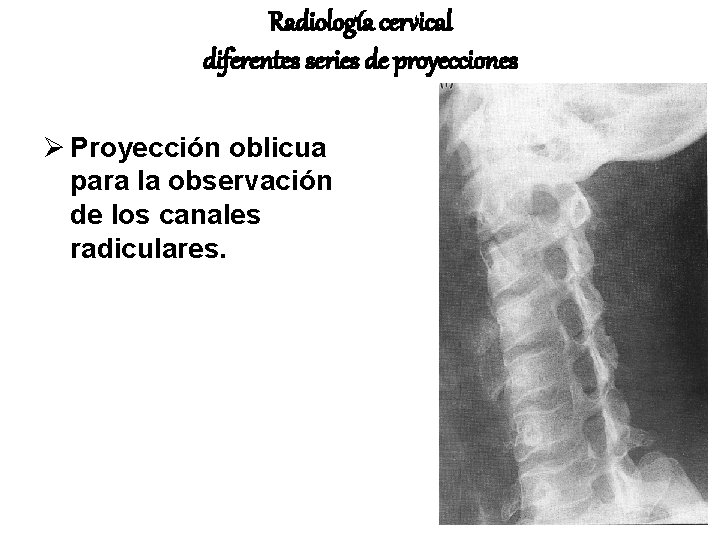 Radiología cervical diferentes series de proyecciones Ø Proyección oblicua para la observación de los