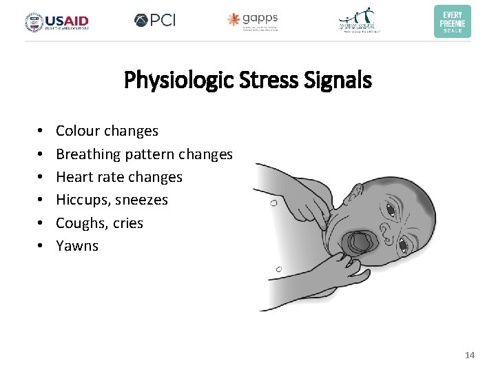 Physiologic Stress Signals • • • Colour changes Breathing pattern changes Heart rate changes Physiologic Stress Signals • • • Colour changes Breathing pattern changes Heart rate changes