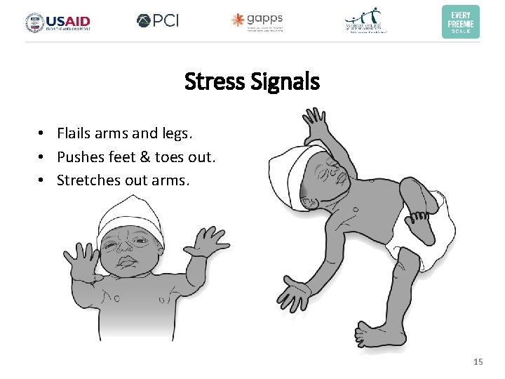 Stress Signals • Flails arms and legs. • Pushes feet & toes out. • Stress Signals • Flails arms and legs. • Pushes feet & toes out. •