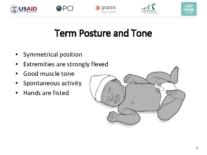 Term Posture and Tone • • • Symmetrical position Extremities are strongly flexed Good Term Posture and Tone • • • Symmetrical position Extremities are strongly flexed Good