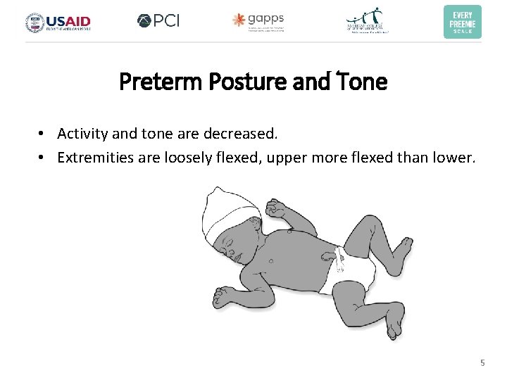 Preterm Posture and Tone • Activity and tone are decreased. • Extremities are loosely Preterm Posture and Tone • Activity and tone are decreased. • Extremities are loosely