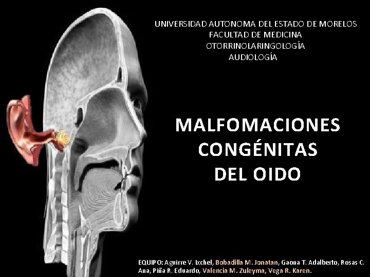 UNIVERSIDAD AUTONOMA DEL ESTADO DE MORELOS FACULTAD DE MEDICINA OTORRINOLARINGOLOGÍA AUDIOLOGÍAR MALFOMACIONES CONGÉNITAS DEL