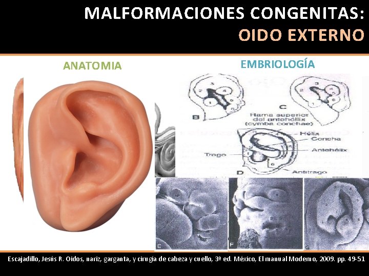 MALFORMACIONES CONGENITAS: OIDO EXTERNO ANATOMIA EMBRIOLOGÍA Escajadillo, Jesús R. Oidos, nariz, garganta, y cirugía