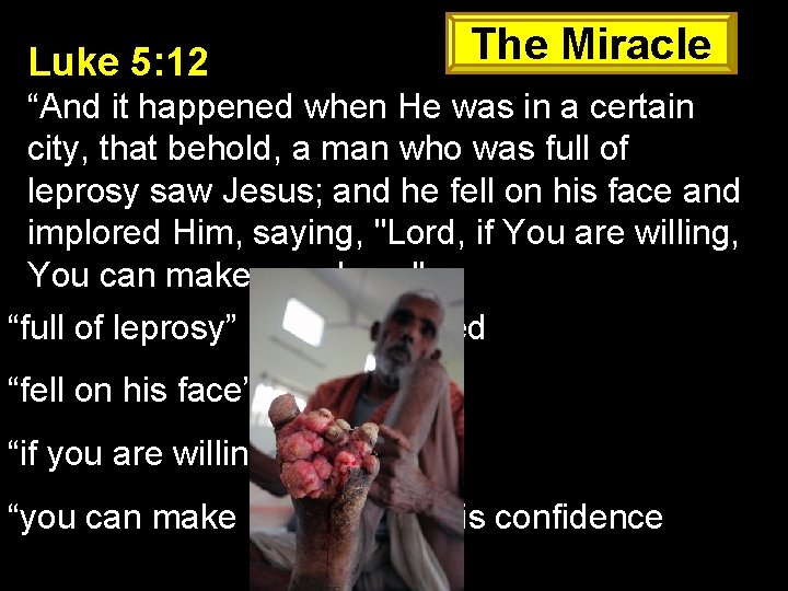 Luke 5: 12 The Miracle “And it happened when He was in a certain