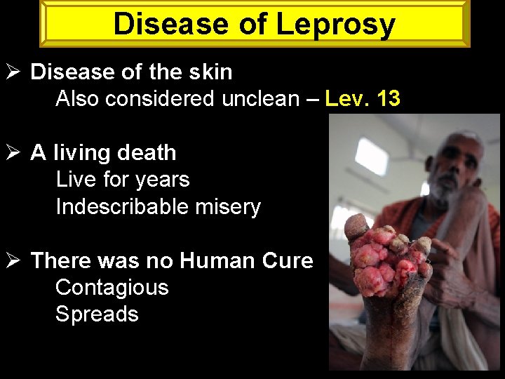 Disease of Leprosy Ø Disease of the skin Also considered unclean – Lev. 13